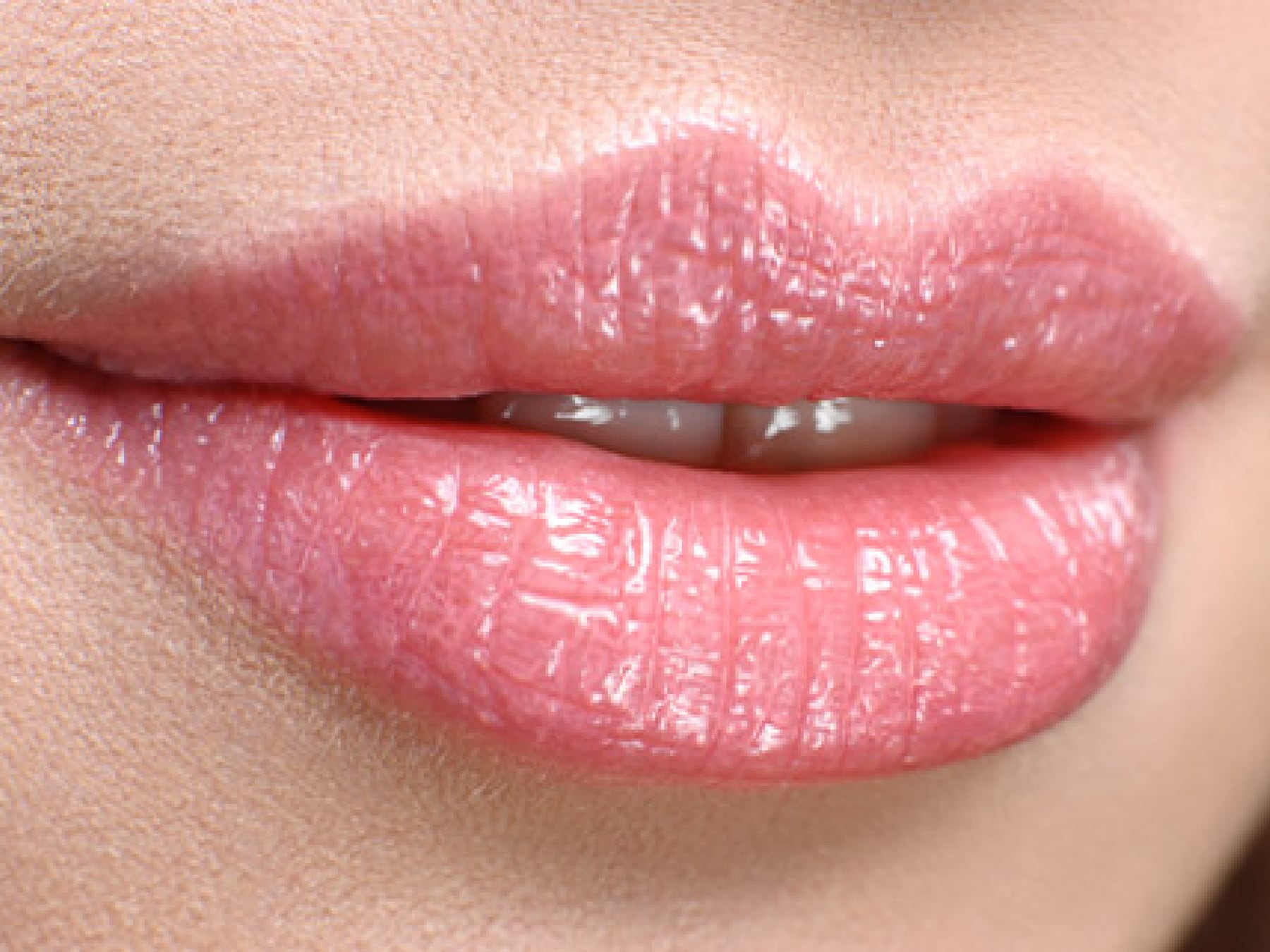 Restylane logo
