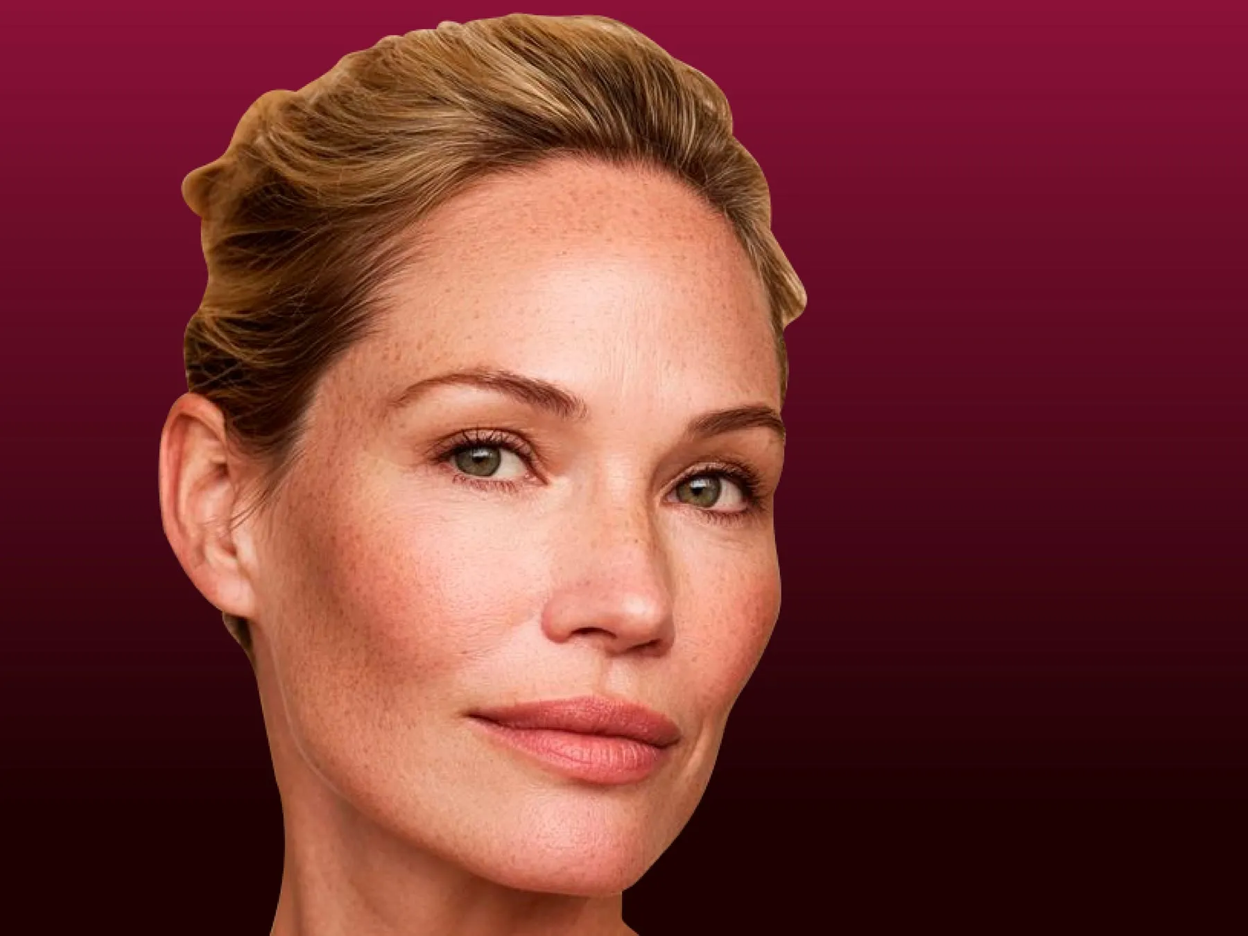Biostimulation at 360° Aesthetics Tijuana