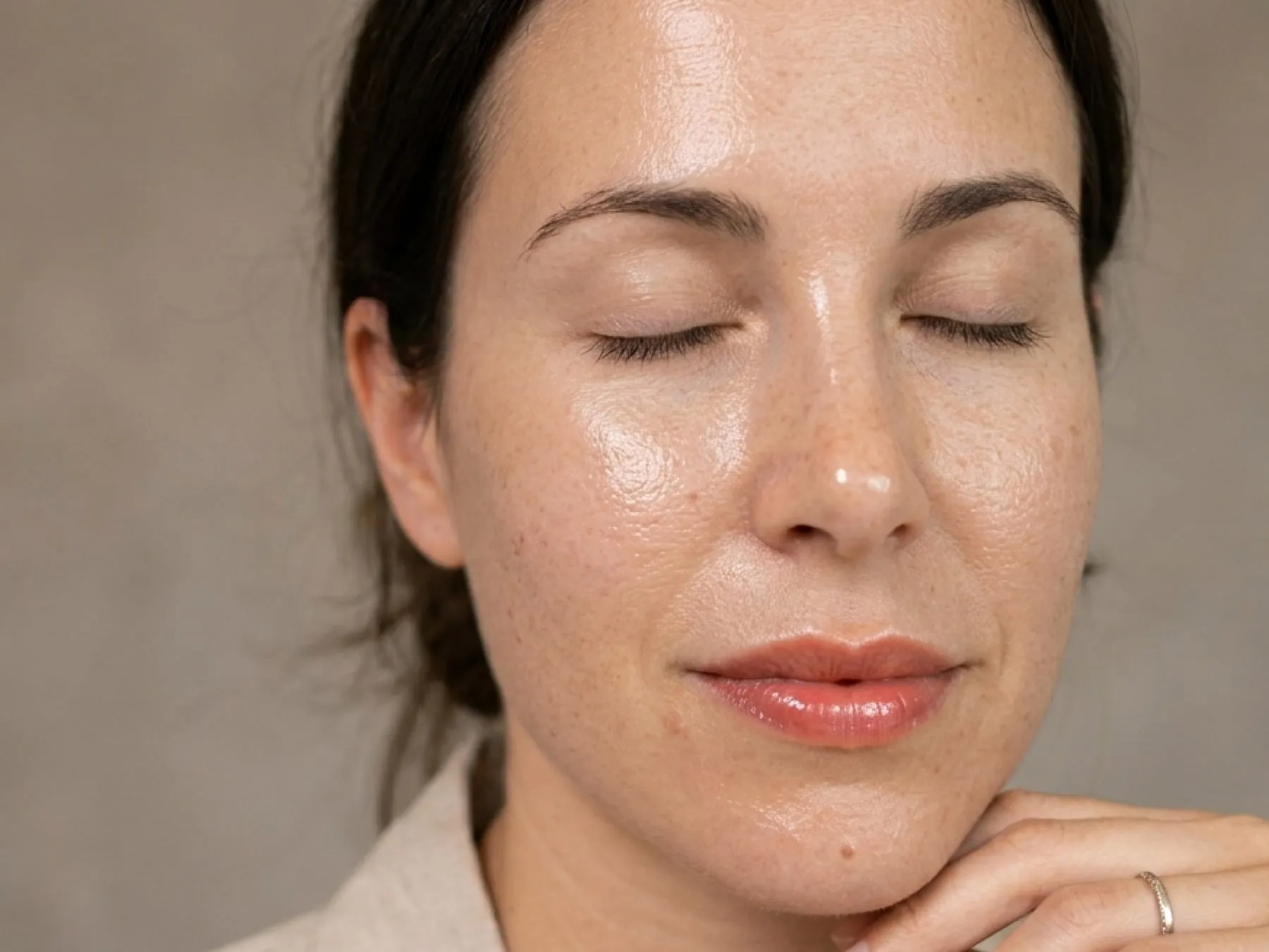 Hyaluronic Acid at 360° Aesthetics Tijuana