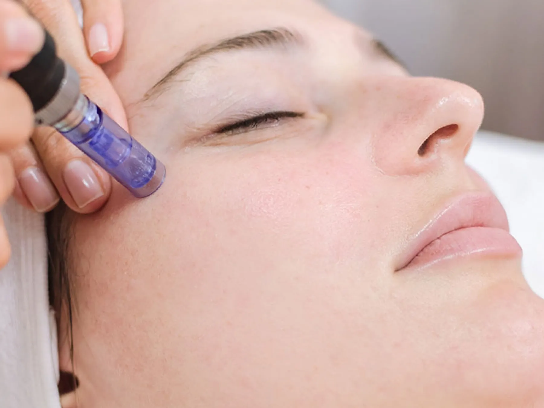 Mesotherapy at 360° Aesthetics Tijuana