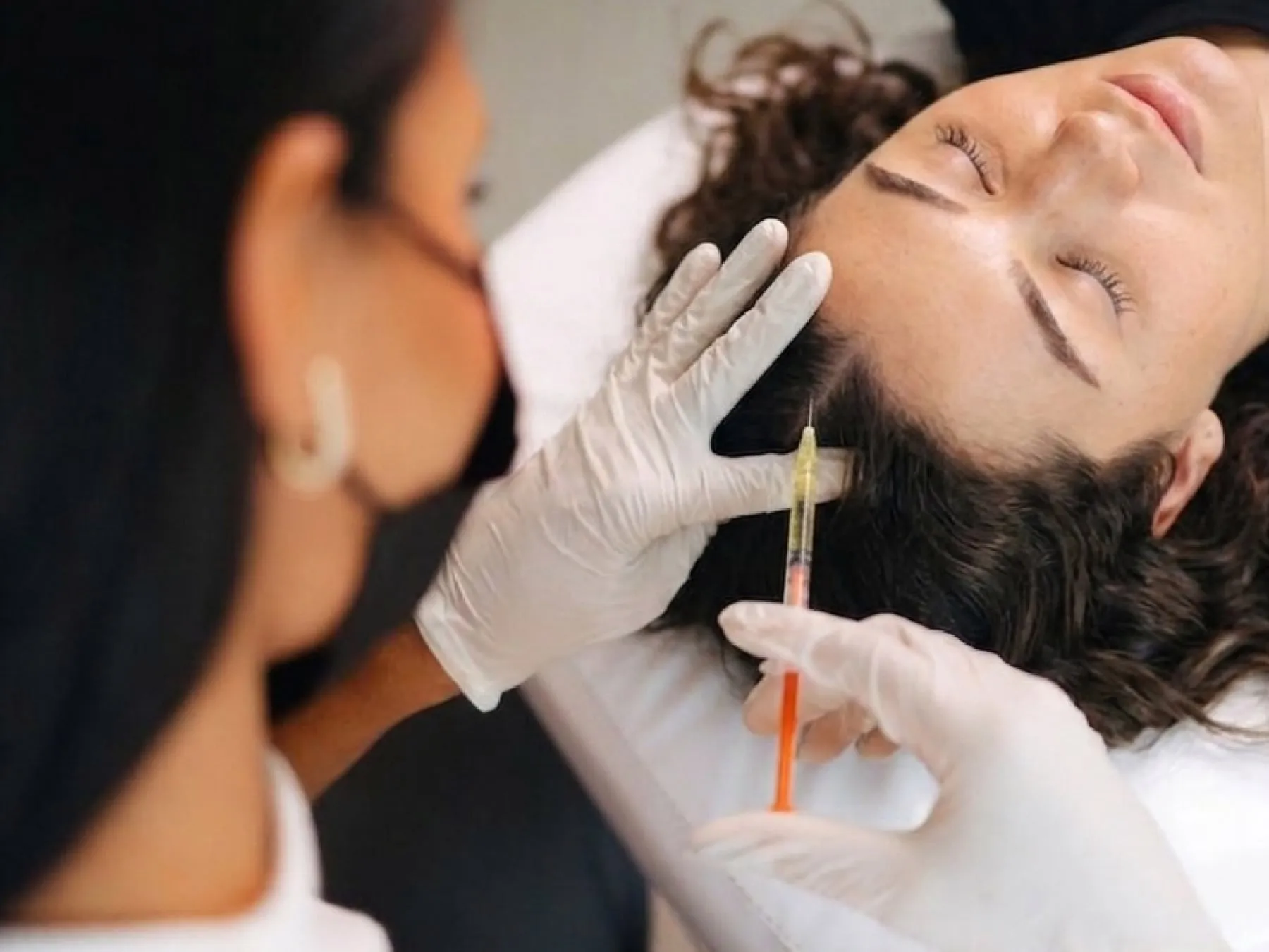 PRP Facial at 360° Aesthetics Tijuana